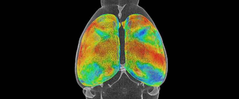 Graphic showing a scan of a brain